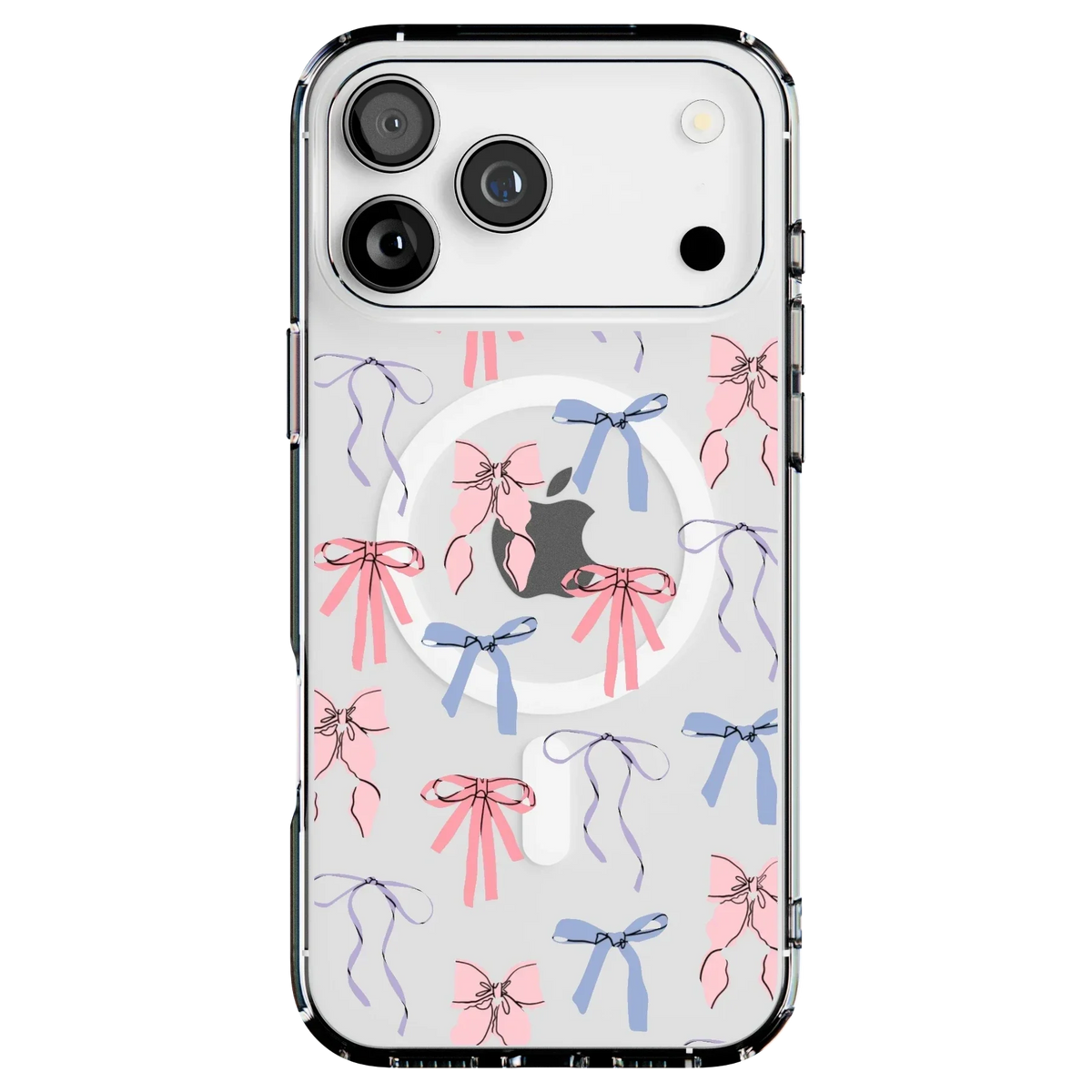 Coquette Girlie | Pastel Bows Case